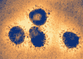 Coronavirus