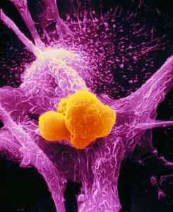A macrophage (purple) attacks a cancer cell (yellow)