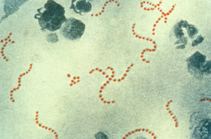 http://www.damninteresting.net/content/streptococcus_pyogenes.jpg