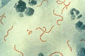 Streptococcus pyogenes